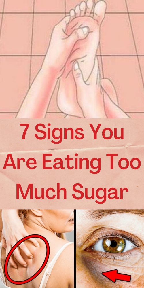 7 Signs Youre Eating Too Much Sugar Health Media 365