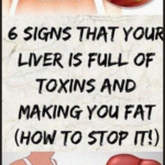 6 Signs That Your Liver Is Full Of Toxins And Making You Fat (And How To Stop It)